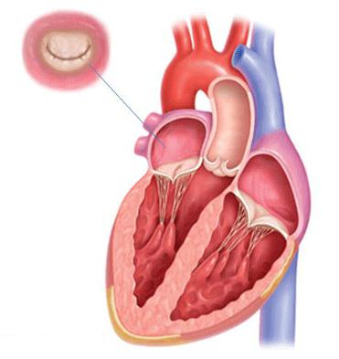 митрального клапана