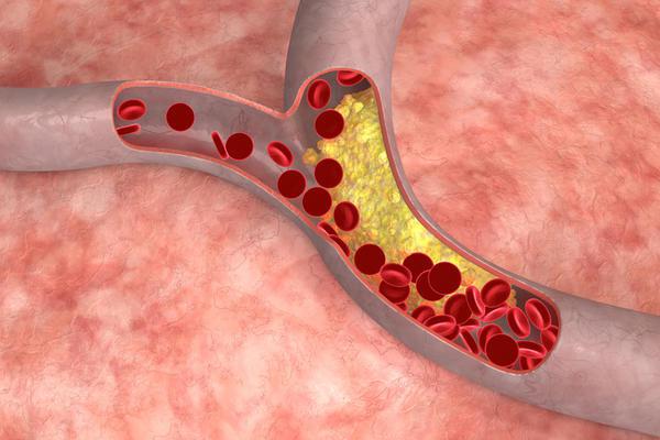 гиперхолестеринемия это