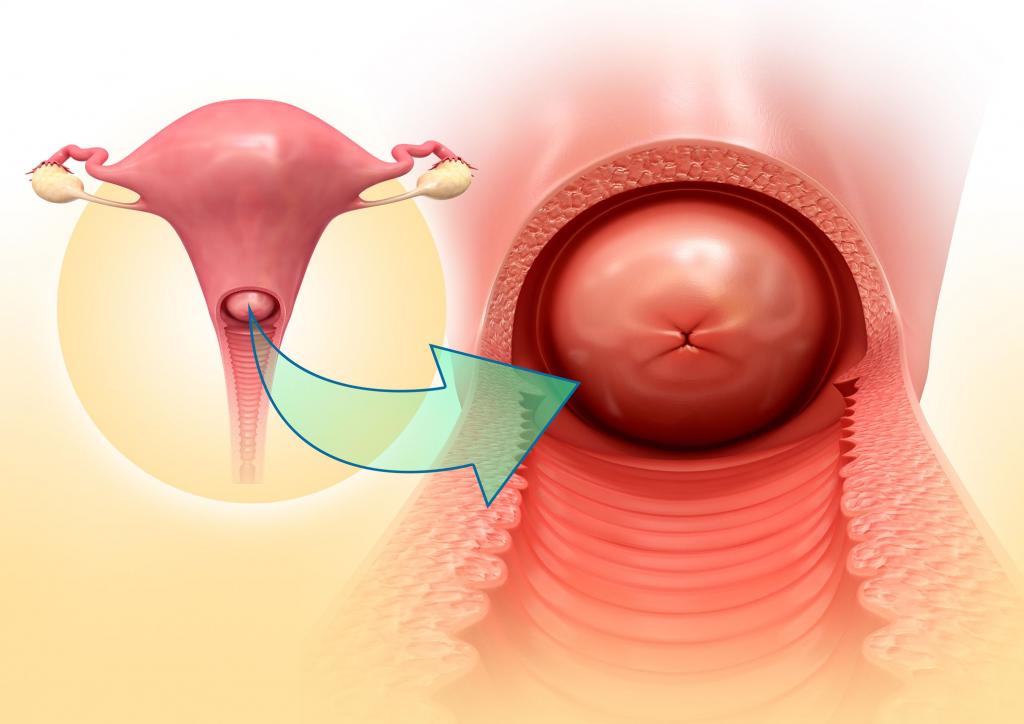 цервикальный канал шейки матки