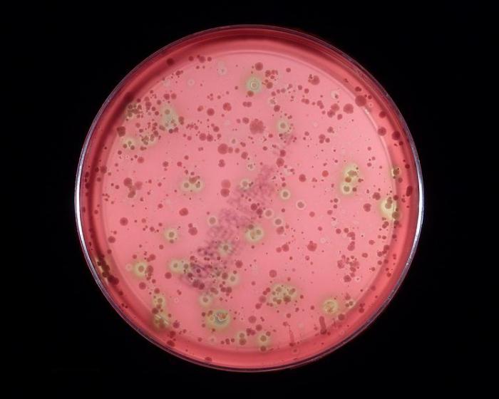 streptococcus group viridans 