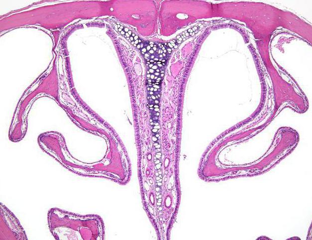 операция на нижних носовых раковинах