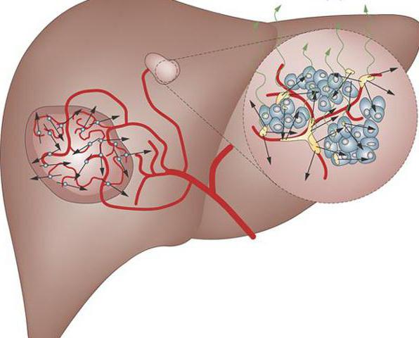 гепатит с и гепатоцеллюлярная карцинома