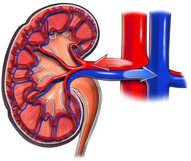 стеноз почечной артерии