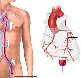 коронарография сосудов сердца