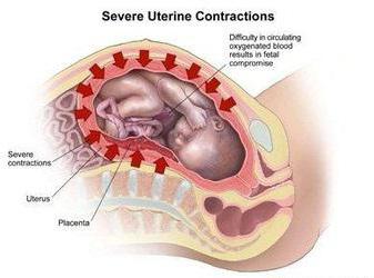 как понять что начались схватки у повторнородящих