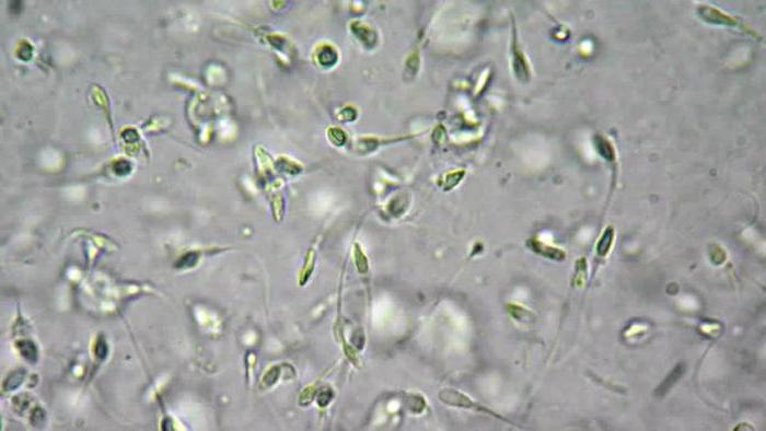 почему сперма стала жидкой 