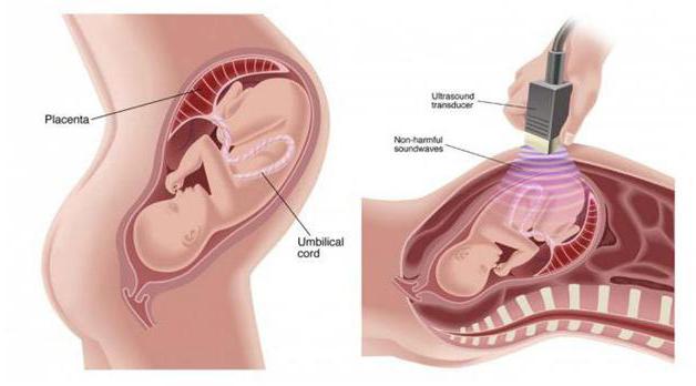 4Д УЗИ при беременности