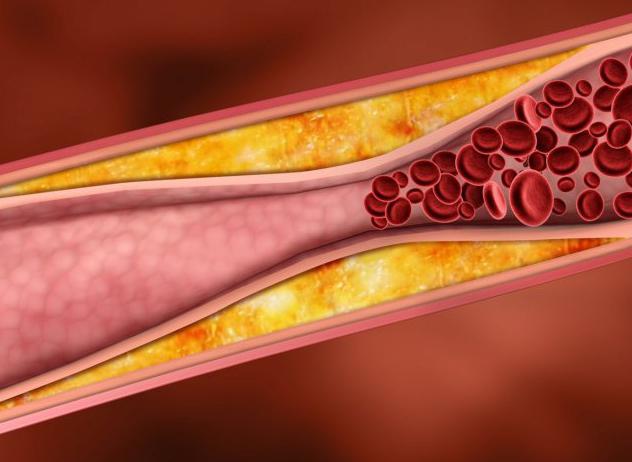 причина спазмы коронарных сосудов