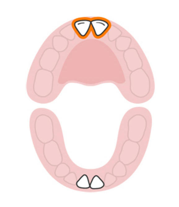 Какие зубы прорезываются первыми