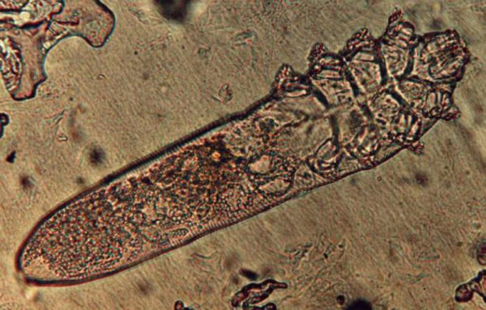 demodex folliculorum