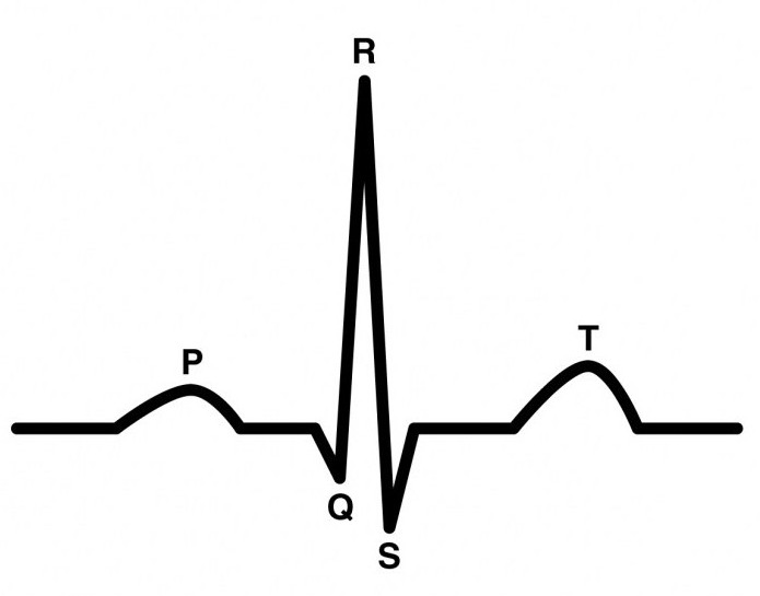 сделать ЭКГ