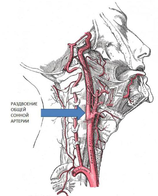 правая общая сонная артерия