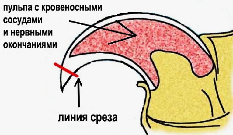 схема ногтя