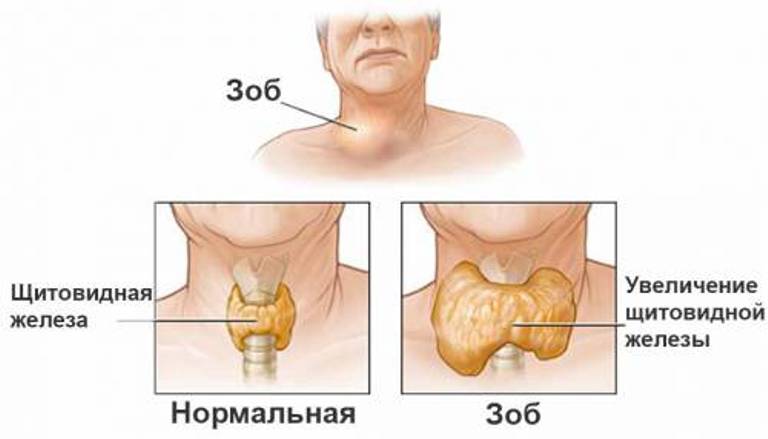 Норма и патология