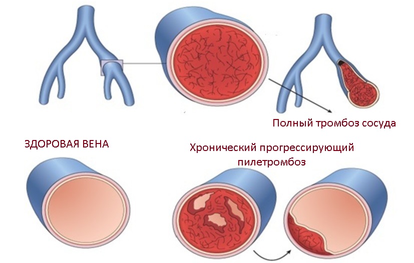 ветви воротной вены анатомия