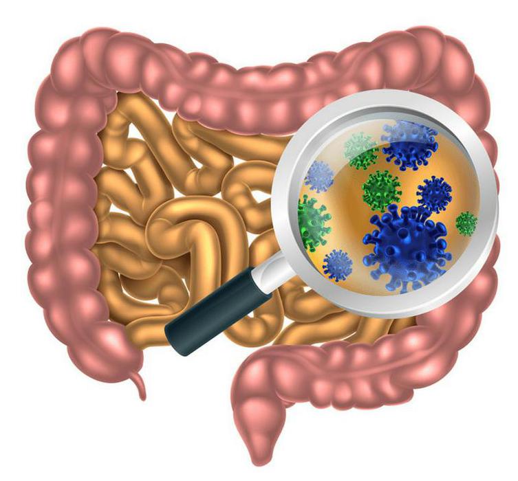 Дисбактериоз кишечника
