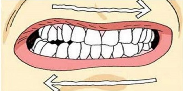 почему во сне стучат зубами