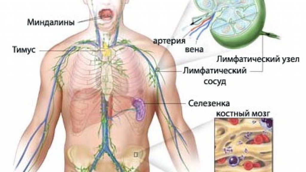 Прогноз при неходжкинской лимфоме