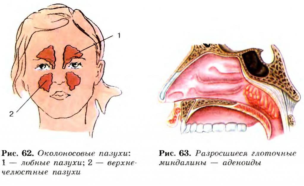 Носовые пазухи