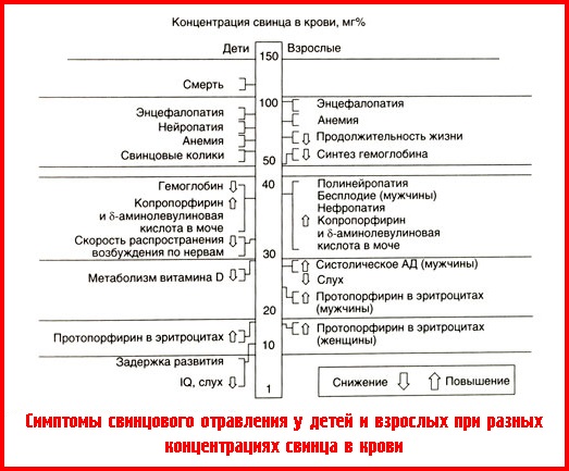 Симптомы свинцового отравления