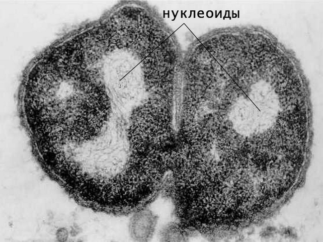 электронная микрофотография нуклеоида