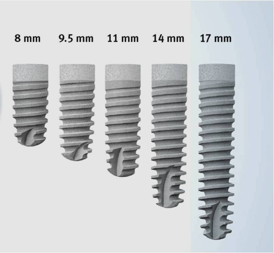 Примеры размеров имплантов